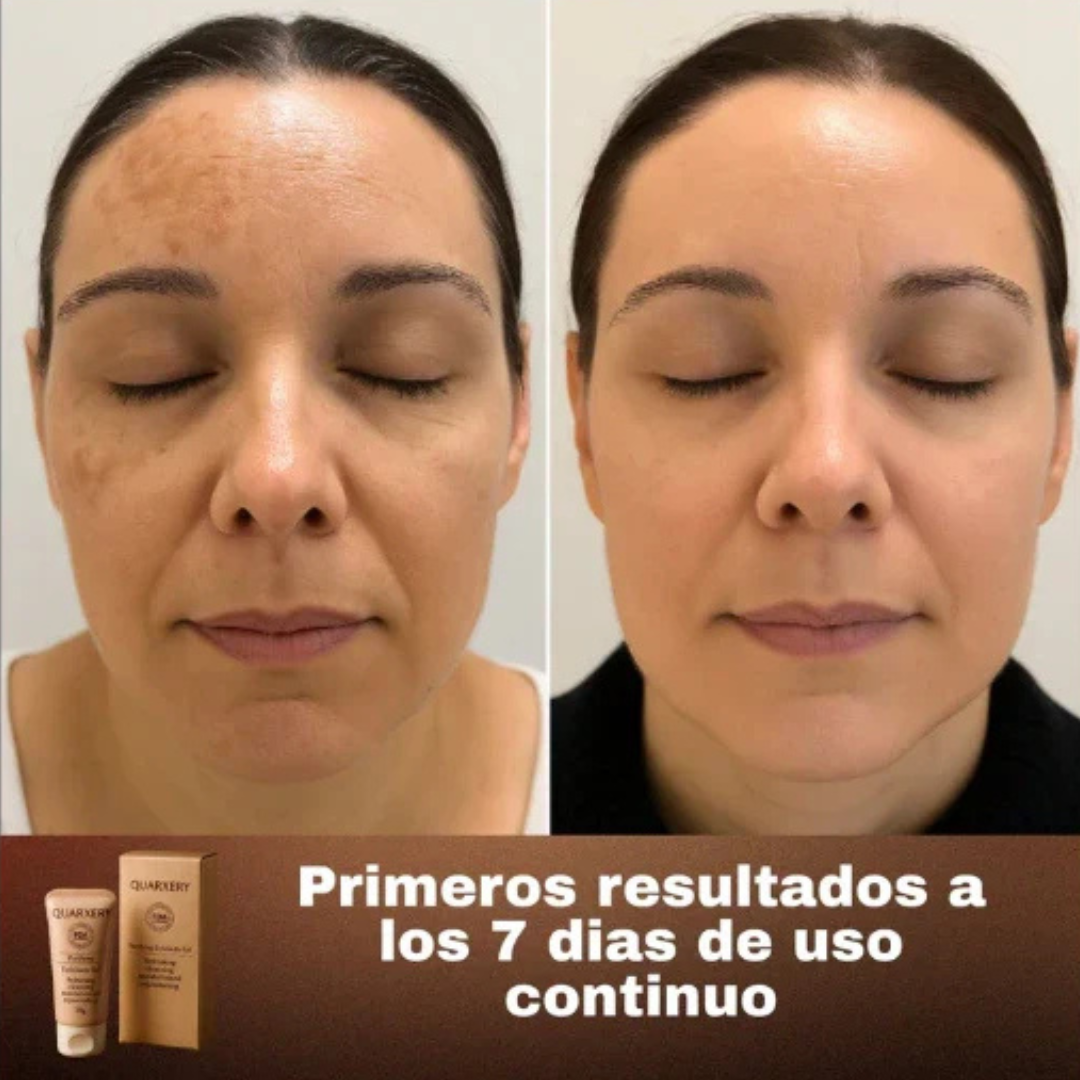 ¡Aprovecha nuestra promoción! Compra 1 y Llévate 2 - Quarxery Gel Exfoliante